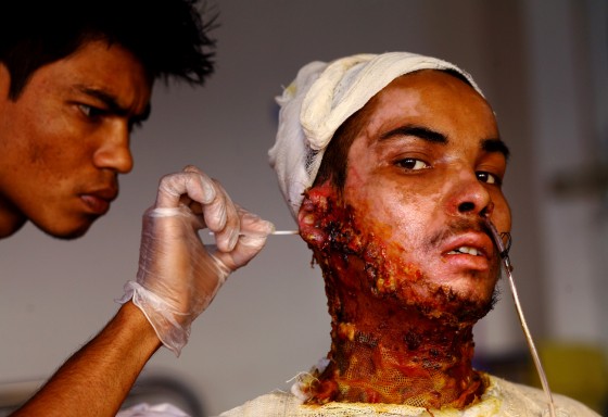Victims of Petrol Bomb