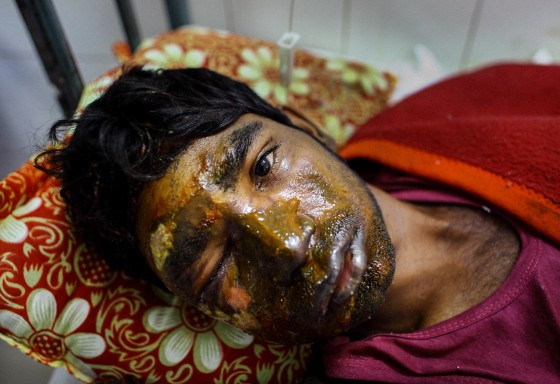 Victims of Petrol Bomb